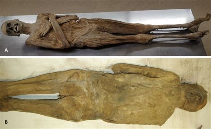 Bones' Night Out Gone Wrong: The Mummified Corpse